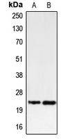 BBC3 / PUMA Antibody - Western blot analysis of PUMA expression in K562 (A); U937 (B) whole cell lysates.