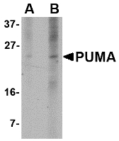 BBC3 / PUMA Antibody - Western blot of PUMA expression in K562 cell lysate with PUMA antibody at (A) 2.5 and (B) 5 ug/ml.