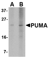 BBC3 / PUMA Antibody - Western blot of PUMA expression in K562 cell lysate with PUMA antibody at (A) 2.5 and (B) 5 ug/ml.