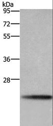 BBC3 / PUMA Antibody - Western blot analysis of A549 cell, using BBC3 Polyclonal Antibody at dilution of 1:600.