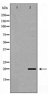 BBC3 / PUMA Antibody - Western blot of BBC3(PUMA) expression in 293 cells