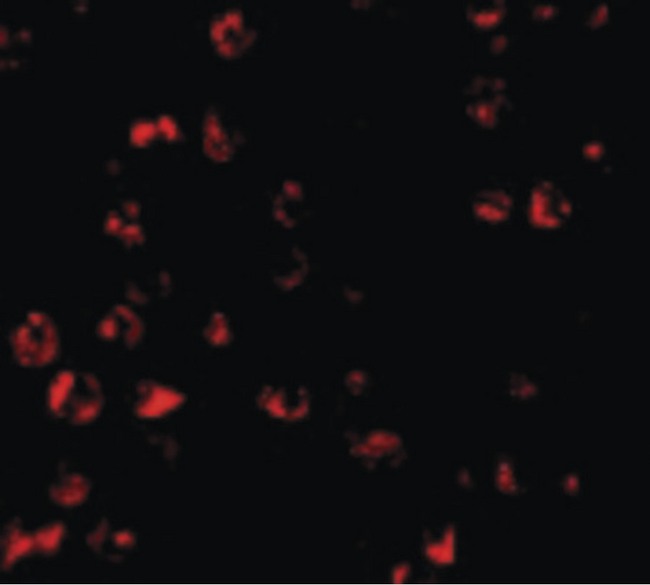 BBC3 / PUMA Antibody - Immunofluorescence of PUMA in K562 cells with PUMA antibody at 10 ug/ml.