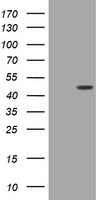 BBOX1 / BBOX Antibody - HEK293T cells were transfected with the pCMV6-ENTRY control (Left lane) or pCMV6-ENTRY BBOX1 (Right lane) cDNA for 48 hrs and lysed. Equivalent amounts of cell lysates (5 ug per lane) were separated by SDS-PAGE and immunoblotted with anti-BBOX1.
