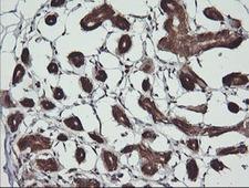 BBOX1 / BBOX Antibody - IHC of paraffin-embedded Human breast tissue using anti-BBOX1 mouse monoclonal antibody. (Heat-induced epitope retrieval by 10mM citric buffer, pH6.0, 120°C for 3min).