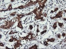 BBOX1 / BBOX Antibody - IHC of paraffin-embedded Human breast tissue using anti-BBOX1 mouse monoclonal antibody.