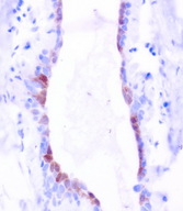 BBOX1 / BBOX Antibody - Immunohistochemical staining of paraffin-embedded human breast duct using anti-BBOX1 mouse monoclonal antibody at 1:200 dilution of 1.0 mg/mL using Polink2 Broad HRP DAB for detection.requires HIER with citrate pH6.0 at 110C for 3 min using pressure chamber/cooker. The image shows strong cytoplasmic, membrane, and nuclear staining in ductal epithelial cells.