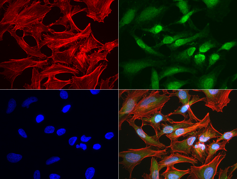 BBOX1 / BBOX Antibody - Immunofluorescent staining of HeLa cells using anti-BBOX1 mouse monoclonal antibody  green, 1:50). Actin filaments were labeled with Alexa Fluor® 594 Phalloidin. (red), and nuclear with DAPI. (blue).