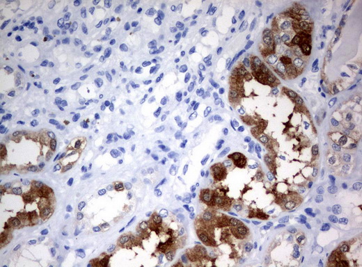 BBOX1 / BBOX Antibody - Immunohistochemical staining of paraffin-embedded Human Kidney tissue using anti-BBOX1 mouse monoclonal antibody.  heat-induced epitope retrieval by 10mM citric buffer, pH6.0, 120C for 3min)