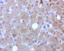 BBOX1 / BBOX Antibody - Immunohistochemical staining of paraffin-embedded human liver using anti-BBOX1 mouse monoclonal antibody at 1:200 dilution of 1.0 mg/mL using Polink2 Broad HRP DAB for detection.requires HIER with citrate pH6.0 at 110C for 3 min using pressure chamber/cooker. The image shows strong cytoplasmic and membrane in the hepatocytes