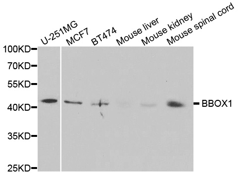 BBOX1 / BBOX Antibody - Western blot analysis of extracts of various cell lines.