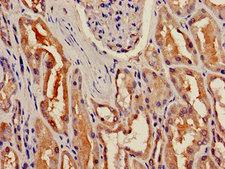 BBOX1 / BBOX Antibody - Immunohistochemistry image of paraffin-embedded human kidney tissue at a dilution of 1:100