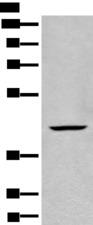 BBOX1 / BBOX Antibody - Western blot analysis of Human kidney tissue lysate  using BBOX1 Polyclonal Antibody at dilution of 1:650