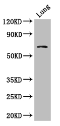 BBS1 Antibody - Positive WB detected in:Mouse lung tissue;All lanes: BBS1 antibody at 1ug/ml;Secondary;Goat polyclonal to rabbit IgG at 1/50000 dilution;Predicted band size: 66,70,50 kDa;Observed band size: 66 kDa;