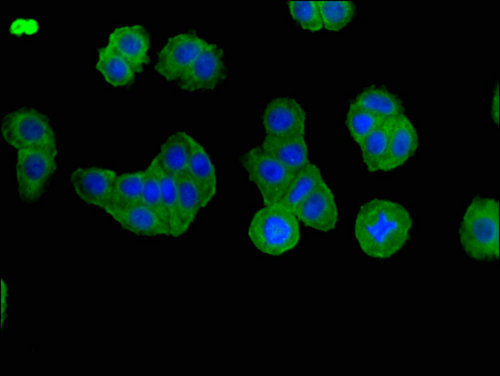 BBS1 Antibody - Immunofluorescent analysis of HepG2 cells using BBS1 Antibody at a dilution of 1:100 and Alexa Fluor 488-congugated AffiniPure Goat Anti-Rabbit IgG(H+L)