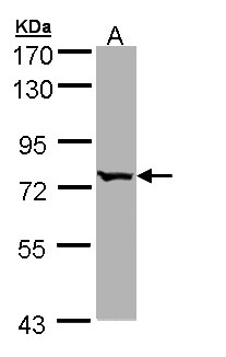 BBS10 Antibody - Sample (30 ug of whole cell lysate). A: Hep G2 . 7.5% SDS PAGE. BBS10 antibody diluted at 1:1000