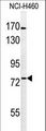 BBS10 Antibody - Western blot of BBS10 Antibody in NCI-H460 cell line lysates (35 ug/lane). BBS10 (arrow) was detected using the purified antibody.