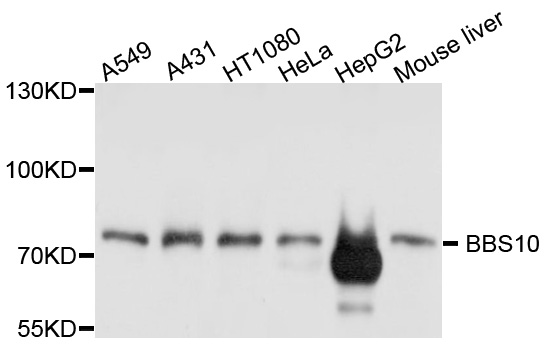 BBS10 Antibody - Western blot analysis of extract of various cells.