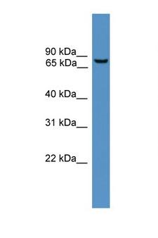 BBS2 / BBS Antibody - BBS2 antibody Western blot of MCF7 Cell lysate. Antibody concentration 1 ug/ml.  This image was taken for the unconjugated form of this product. Other forms have not been tested.