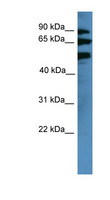 BBS2 / BBS Antibody - BBS2 antibody Western blot of COLO205 cell lysate.  This image was taken for the unconjugated form of this product. Other forms have not been tested.