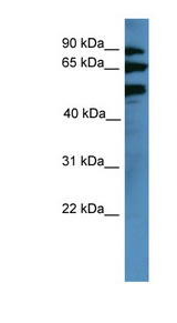 BBS2 / BBS Antibody - BBS2 antibody Western blot of COLO205 cell lysate.  This image was taken for the unconjugated form of this product. Other forms have not been tested.