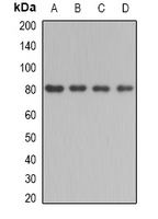 BBS2 / BBS Antibody - Western blot analysis of BBS2 expression in mouse testis (A); mouse kidney (B); rat liver (C); rat brain (D) whole cell lysates.
