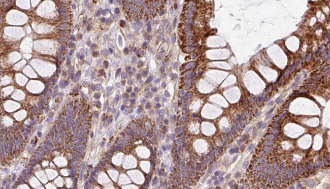BBS2 / BBS Antibody - 1:100 staining mouse colon tissue by IHC-P. The sample was formaldehyde fixed and a heat mediated antigen retrieval step in citrate buffer was performed. The sample was then blocked and incubated with the antibody for 1.5 hours at 22°C. An HRP conjugated goat anti-rabbit antibody was used as the secondary.