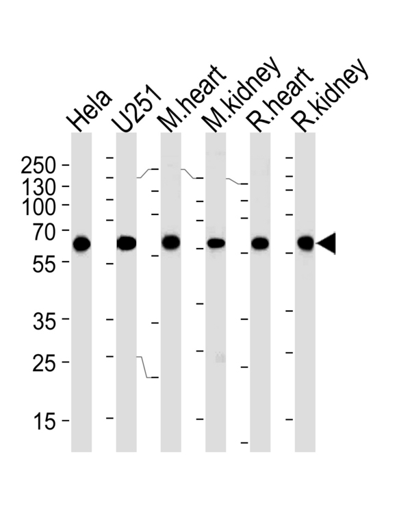 BBS4 Antibody - Western blot of lysates from HeLa, U251 cell line, mouse heart and kidney, rat heart and kidney tissue (from left to right) with PHB Antibody. Antibody was diluted at 1:1000 at each lane. A goat anti-mouse IgG H&L (HRP) at 1:3000 dilution was used as the secondary antibody. Lysates at 35 ug per lane.