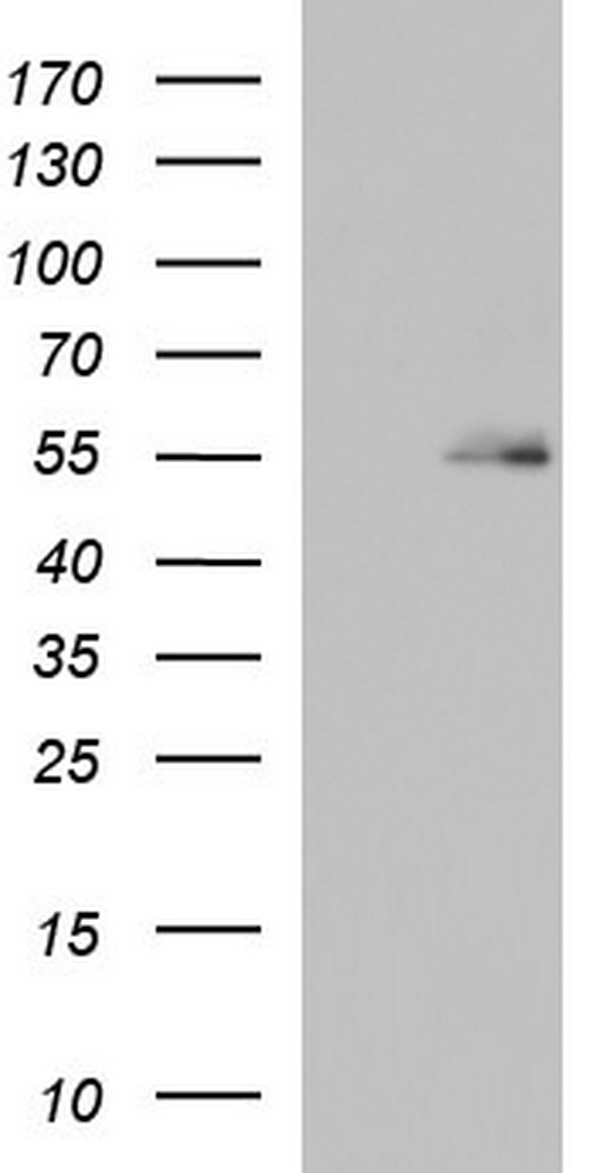 BBS4 Antibody - HEK293T cells were transfected with the pCMV6-ENTRY control. (Left lane) or pCMV6-ENTRY BBS4. (Right lane) cDNA for 48 hrs and lysed. Equivalent amounts of cell lysates. (5 ug per lane) were separated by SDS-PAGE and immunoblotted with anti-BBS4.