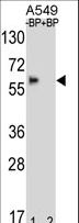 BBS4 Antibody - Western blot of BBS4 Antibody antibody pre-incubated without(lane 1) and with(lane 2) blocking peptide in A549 cell line lysate. BBS4 Antibody (arrow) was detected using the purified antibody.