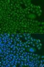 BBS4 Antibody - Immunofluorescence analysis of U2OS cells using BBS4 Polyclonal Antibody at dilution of 1:100.Blue: DAPI for nuclear staining.