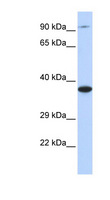 BBS5 Antibody - BBS5 antibody Western blot of 293T cell lysate. This image was taken for the unconjugated form of this product. Other forms have not been tested.