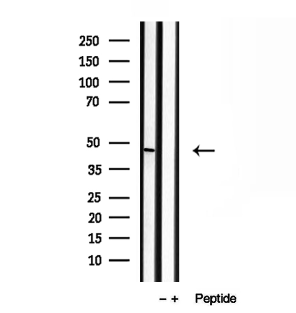 BBS5 Antibody - Western blot analysis of extracts of mouse testis tissue using BBS5 antibody.