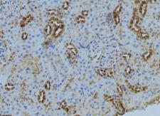 BBS5 Antibody - 1:100 staining mouse kidney tissue by IHC-P. The sample was formaldehyde fixed and a heat mediated antigen retrieval step in citrate buffer was performed. The sample was then blocked and incubated with the antibody for 1.5 hours at 22°C. An HRP conjugated goat anti-rabbit antibody was used as the secondary.