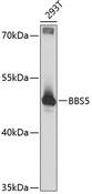 BBS5 Antibody - Western blot analysis of extracts of 293T cells using BBS5 Polyclonal Antibody at dilution of 1:3000.