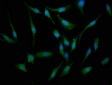 BBS7 Antibody - Immunofluorescence staining of Hela cells at a dilution of 1:133, counter-stained with DAPI. The cells were fixed in 4% formaldehyde, permeabilized using 0.2% Triton X-100 and blocked in 10% normal Goat Serum. The cells were then incubated with the antibody overnight at 4 °C.The secondary antibody was Alexa Fluor 488-congugated AffiniPure Goat Anti-Rabbit IgG (H+L) .