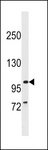 BBS9 Antibody - PTHB1 Antibody western blot of CEM cell line lysates (35 ug/lane). The PTHB1 antibody detected the PTHB1 protein (arrow).
