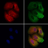 BBS9 Antibody - Staining HeLa cells by IF/ICC. The samples were fixed with PFA and permeabilized in 0.1% Triton X-100, then blocked in 10% serum for 45 min at 25°C. Samples were then incubated with primary Ab(1:200) and mouse anti-beta tubulin Ab(1:200) for 1 hour at 37°C. An AlexaFluor594 conjugated goat anti-rabbit IgG(H+L) Ab(1:200 Red) and an AlexaFluor488 conjugated goat anti-mouse IgG(H+L) Ab(1:600 Green) were used as the secondary antibod