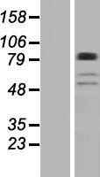 BBS9 Protein - Western validation with an anti-DDK antibody * L: Control HEK293 lysate R: Over-expression lysate