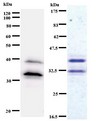 BBX Antibody - Western blot of immunized recombinant protein using BBX antibody. Left: BBX staining. Right: Coomassie Blue staining of immunized recombinant protein.