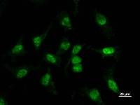 BBX Antibody - Immunostaining analysis in HeLa cells. HeLa cells were fixed with 4% paraformaldehyde and permeabilized with 0.1% Triton X-100 in PBS. The cells were immunostained with anti-BBX mAb.
