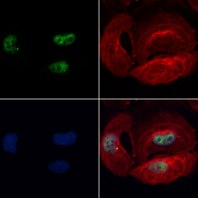 BBX Antibody - Staining HeLa cells by IF/ICC. The samples were fixed with PFA and permeabilized in 0.1% Triton X-100, then blocked in 10% serum for 45 min at 25°C. Samples were then incubated with primary Ab(1:100) and mouse anti-beta tubulin Ab(1:200) for 1 hour at 37°C. An AlexaFluor594 conjugated goat anti-mouse IgG(H+L) Ab(1:200 Red) and an AlexaFluor488 conjugated goat anti-rabbit IgG(H+L) Ab(1:600 Green) were used as the secondary antibod