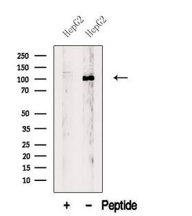 BBX Antibody - Western blot analysis of extracts of HepG2 cells using BBX antibody. The lane on the left was treated with blocking peptide.