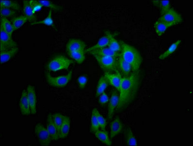 BCAM / CD239 Antibody - Immunofluorescence staining of HepG2 cells with BCAM Antibody at 1:200, counter-stained with DAPI. The cells were fixed in 4% formaldehyde, permeabilized using 0.2% Triton X-100 and blocked in 10% normal Goat Serum. The cells were then incubated with the antibody overnight at 4°C. The secondary antibody was Alexa Fluor 488-congugated AffiniPure Goat Anti-Rabbit IgG(H+L).