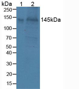 BCAN / Brevican Antibody - Western Blot; Sample: Lane1: Porcine Brain Tissue; Lane2: Mouse Brain Tissue.