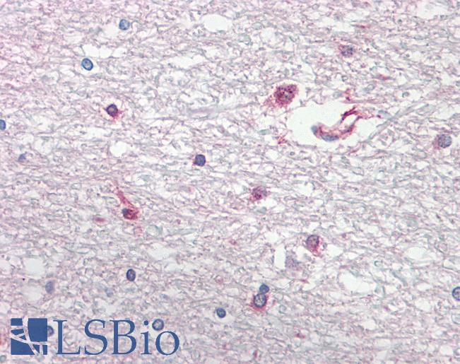 BCAN / Brevican Antibody - Anti-BCAN / Brevican antibody IHC of human brain, cortex, white matter. Immunohistochemistry of formalin-fixed, paraffin-embedded tissue after heat-induced antigen retrieval. Antibody dilution 2.5-5 ug/ml. This image was taken for the unconjugated form of this product. Other forms have not been tested.