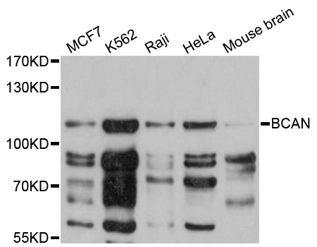 BCAN / Brevican Antibody - Western blot analysis of extracts of various cell lines.