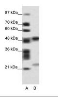 BCAP / PHF11 Antibody - A: Marker, B: HepG2 Cell Lysate.  This image was taken for the unconjugated form of this product. Other forms have not been tested.