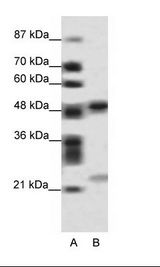 BCAP / PHF11 Antibody - A: Marker, B: HepG2 Cell Lysate.  This image was taken for the unconjugated form of this product. Other forms have not been tested.