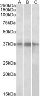 BCAP / PHF11 Antibody - Goat Anti-PHF11 Antibody (1µg/ml) staining of Daudi,(A) Jurkat (B) and Jurkat nuclear (C) lysates (35µg protein in RIPA buffer). Primary incubation was 1 hour. Detected by chemiluminescencence