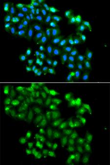 BCAP / PHF11 Antibody - Immunofluorescence analysis of A549 cells.